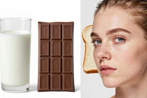 5 foods that can trigger cystic acne, according to dermatologists