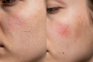 Is It Dry Skin or a Skin Condition? 5 Key Symptoms to Check