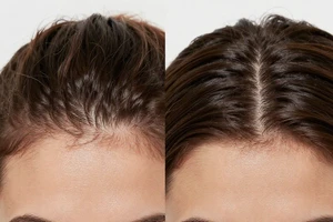 a practical explainer: how to identify and fix scalp dehydration