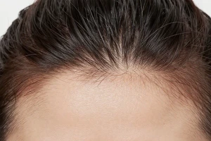 expert-backed ingredient swaps for a healthier, moisturized scalp