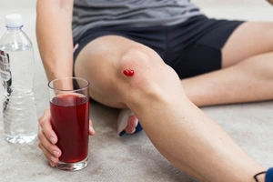 Hydration and Knee Health: What to Drink for Better Workout Recovery