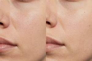 3 Warning Signs Your Wrinkles Are Linked to Dehydration, Not Just Age