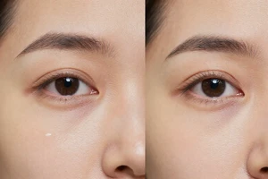 Fine Lines 101: A Practical Guide to Causes and Everyday Management