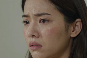 3 Warning Signs Your Oily Skin Products Are Too Harsh for Sensitivity