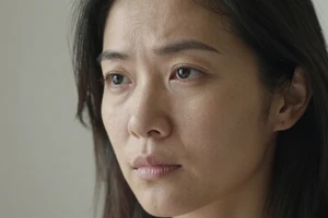 What Your Forehead Wrinkles Might Signal About Your Daily Habits