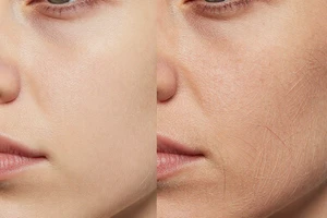 What Dermatologists Want You to Know About Preventing Skin Elasticity Loss