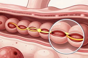 How to Test for Leaky Gut: Diagnosis Options and Home Monitoring Tips