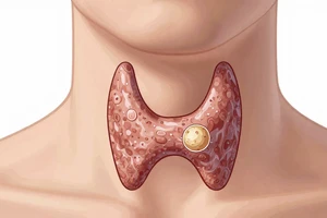 7 Warning Signs of Thyroid Nodules You Shouldn't Ignore