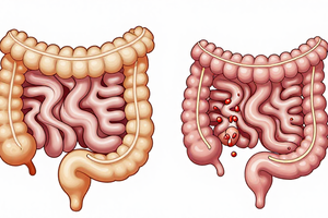 A Practical Guide to Leaky Gut Syndrome: Symptoms, Causes, and Next Steps