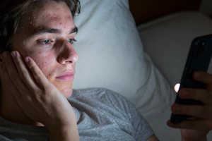 The 2 Nighttime Habits That Can Worsen Acne-Prone Skin