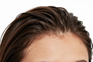 2 Warning Signs Your Oily Scalp Is Actually Dehydrated