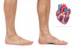 Leg Swelling and Your Heart: 5 Warning Signs You Shouldn't Ignore