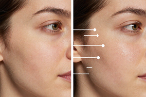 3 Warning Signs Your Sun Spots Are Linked to Sugar Intake, Not Just Sun