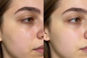 Sun Spots Explained: A Practical Guide to Causes and Home Remedies