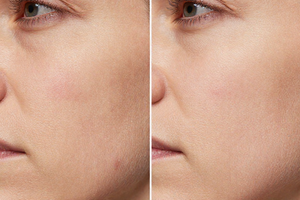 Is It Normal Aging or a Reaction? 3 Signs to Discuss with a Dermatologist