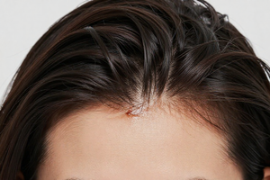 Warning Signs Your Oily Scalp Needs a Product Change, Not More Washing
