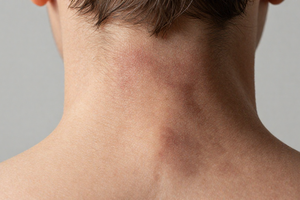 3 Often-Overlooked Warning Signs of Prediabetes You Shouldn't Ignore
