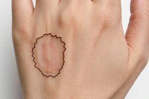 3 Early Warning Signs Your Age Spots Need a Different Prevention Plan
