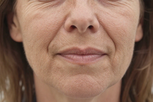 4 signs your collagen production is slowing down (and what to do about it)