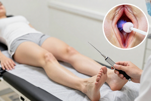 The practical explainer on what to expect during a cervical cancer screening