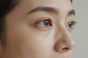 Is your skin telling you collagen is dropping? 5 early warning signs