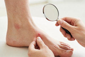 7 warning signs of diabetic foot problems you shouldn’t ignore