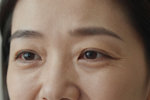 6 warning signs fine lines are becoming deeper wrinkles