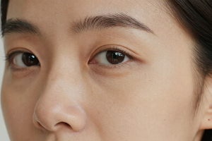 5 early symptoms of sun damage that look like normal aging