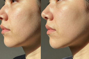 Expert-backed advice: how to check your skin for hidden sun damage