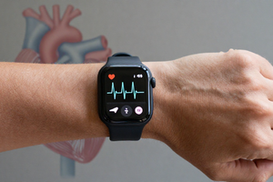 What your heart rate variability says about coronary artery health