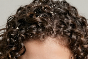 The over-washing mistake that makes dandruff flakes worse on curls