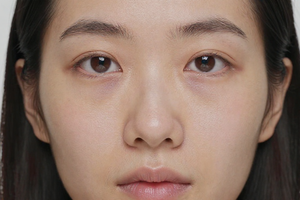 3 hidden signs of dehydration that show up on your face first