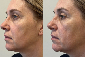 7 warning signs your mature skin is losing collagen faster than expected