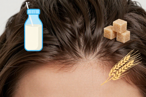 3 foods that may trigger hair breakage if your dry scalp is a reaction
