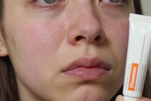 3 warning signs your retinoid routine is irritating your skin, not improving it