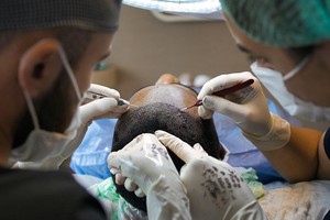 A practical explainer: how to identify and remove scalp buildup on curly hair