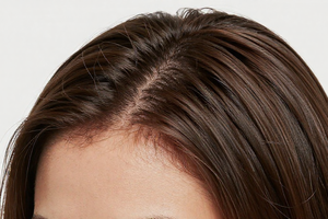 4 common mistakes that turn a dry scalp into a hair breakage problem