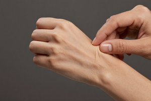4 warning signs your skin needs more protein to maintain firmness