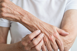 6 warning signs of dry aging skin you shouldn't ignore after 50