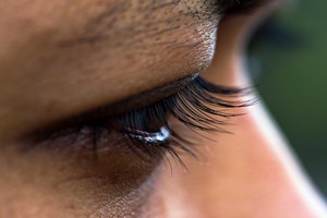 4 foods to avoid if you notice deepening horizontal forehead creases