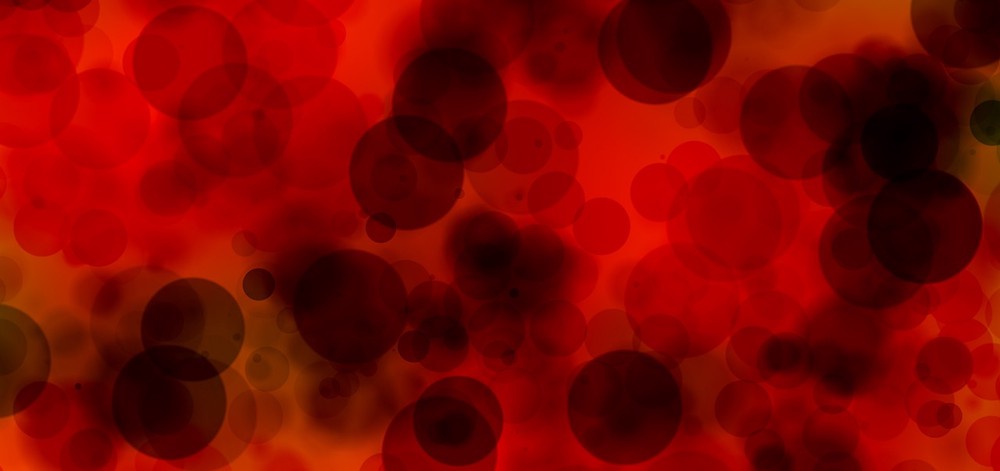 6 everyday habits that cause blood sugar swings in people with diabetes