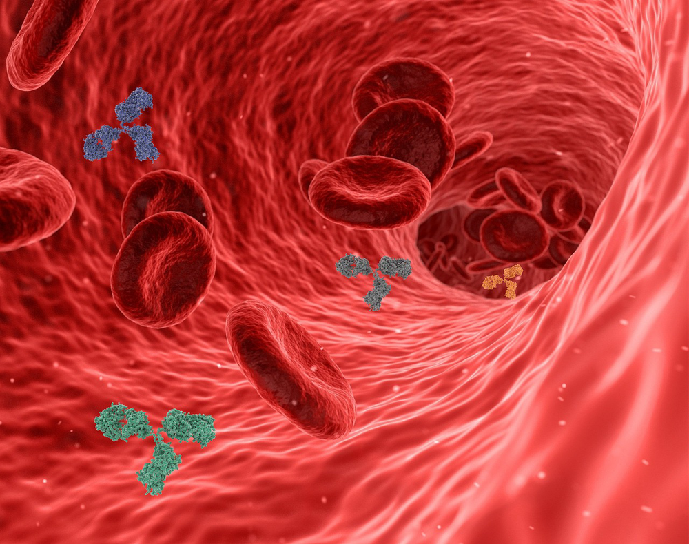 What causes arterial plaque: 4 expert-backed explanations