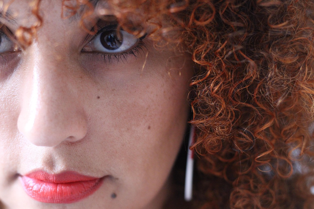 2 subtle symptoms that distinguish post-acne marks from melasma